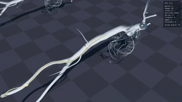 Catheter path highlighted in a 3D vascular model.