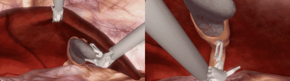 Robotic instruments manipulating simulated abdominal tissue.
